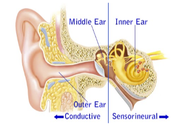 Hearing Loss and Communication image