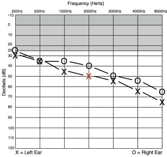 The Audiogram